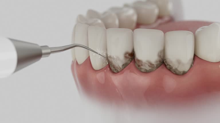 Reliable Dental contractor in Glendale, MS by Smile Center Dentistry